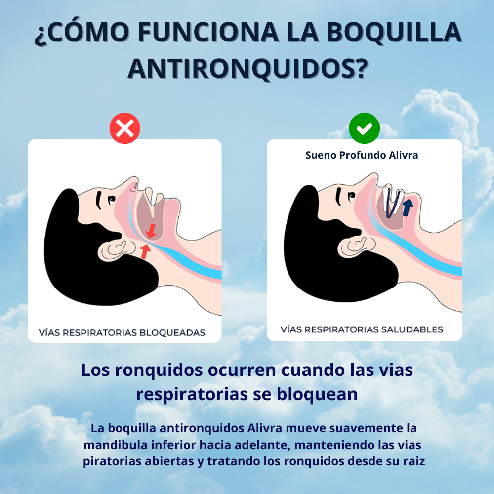 Boquilla antironquidos AlivraMX™