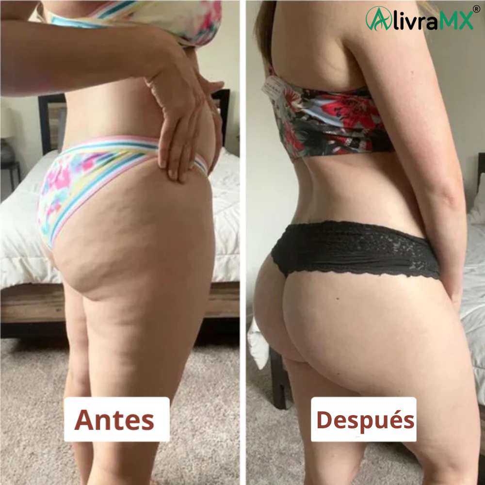 Rodillo de masaje anticelulítico, tejidos profundos - AlivraMX™